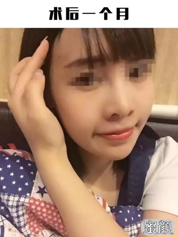 https://img.yiyiaimei.com/mnt/timg/200729/1042563612-3.jpg