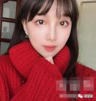 案例图片