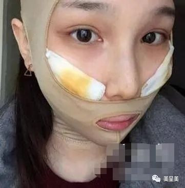 案例图片