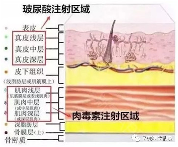 案例图片