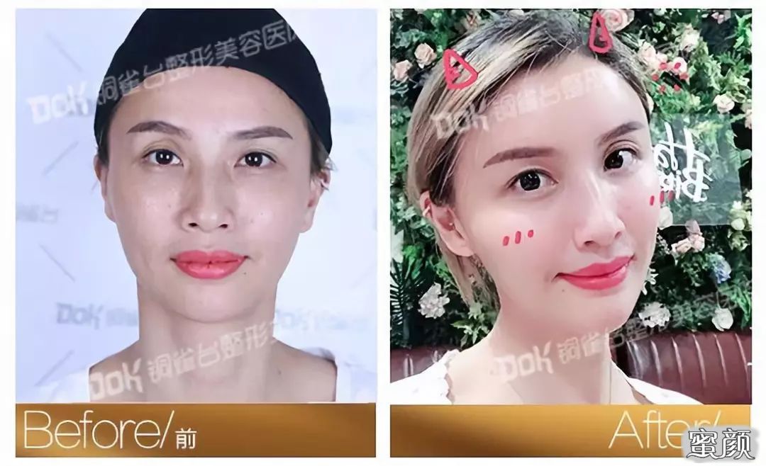 https://img.yiyiaimei.com/mnt/timg/200730/140ZK3A-7.jpg