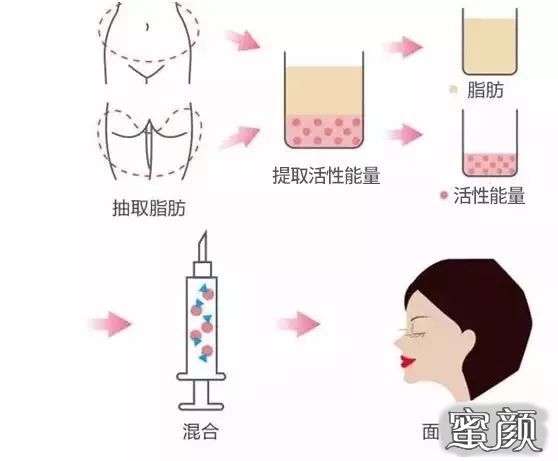 https://img.yiyiaimei.com/mnt/timg/200730/140ZT3Q-9.jpg
