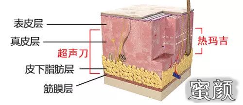 https://img.yiyiaimei.com/mnt/timg/200730/14561234P-0.jpg