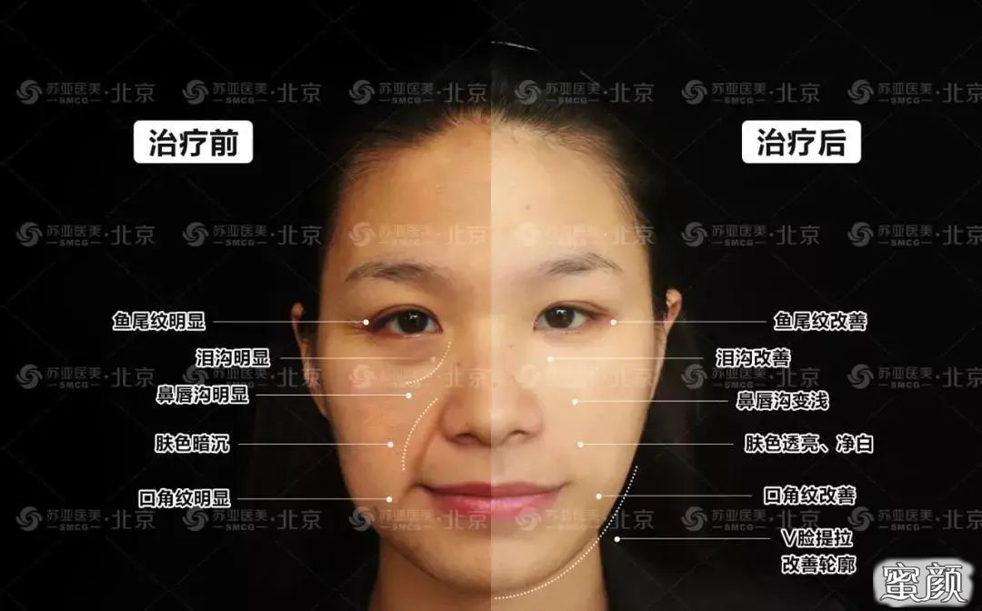 https://img.yiyiaimei.com/mnt/timg/200730/145620I02-3.jpg