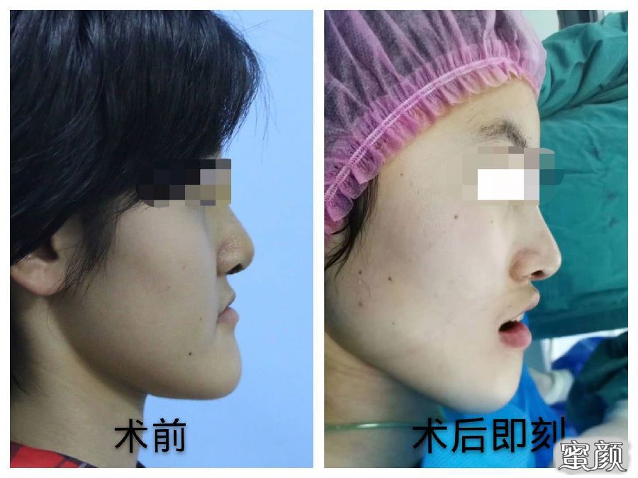 案例图片