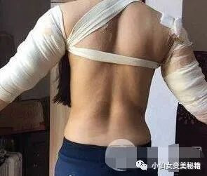 案例图片