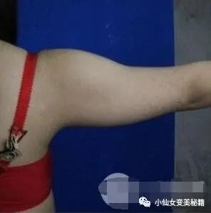 案例图片