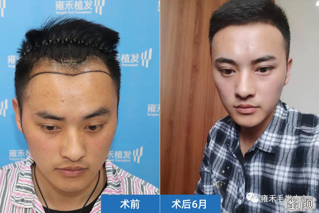 案例图片
