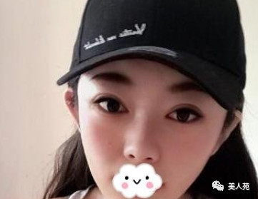 案例图片