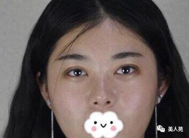 案例图片