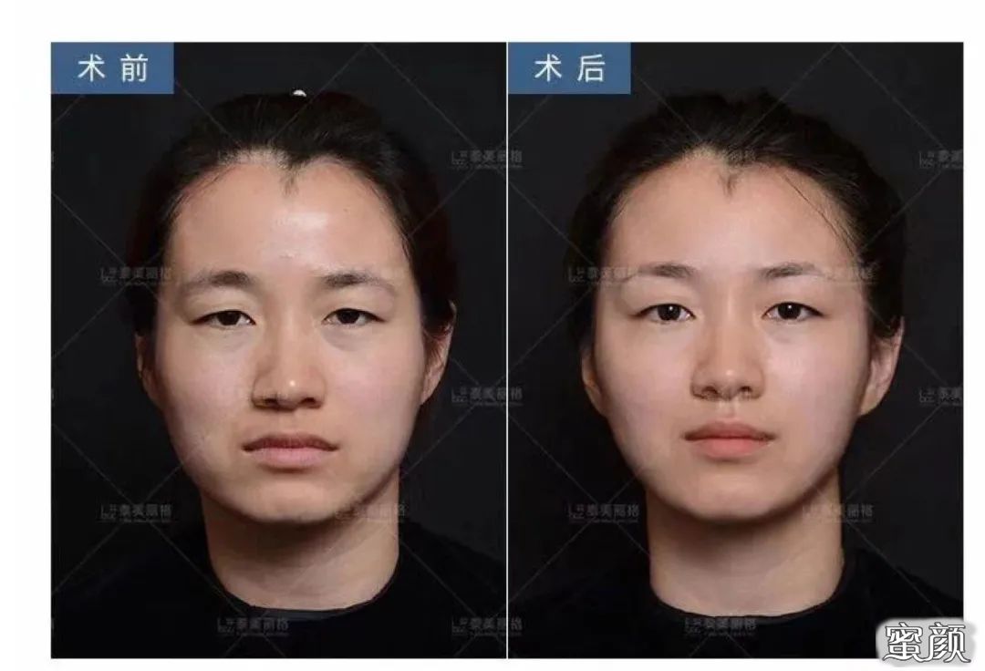 案例图片
