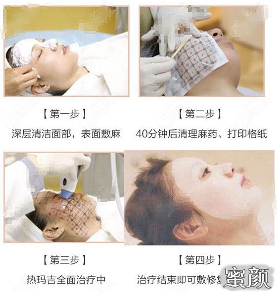 案例图片