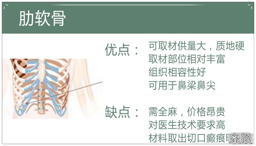 案例图片