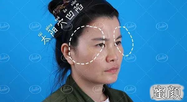案例图片