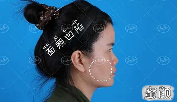 案例图片