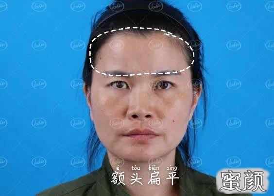 案例图片