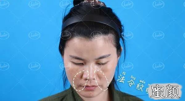 案例图片