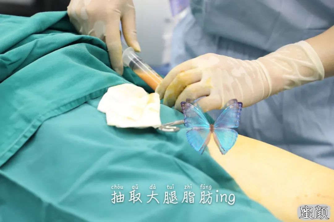 案例图片