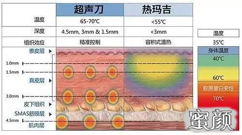 https://img.yiyiaimei.com/mnt/timg/200802/13001JJ5-9.jpg 案例图片