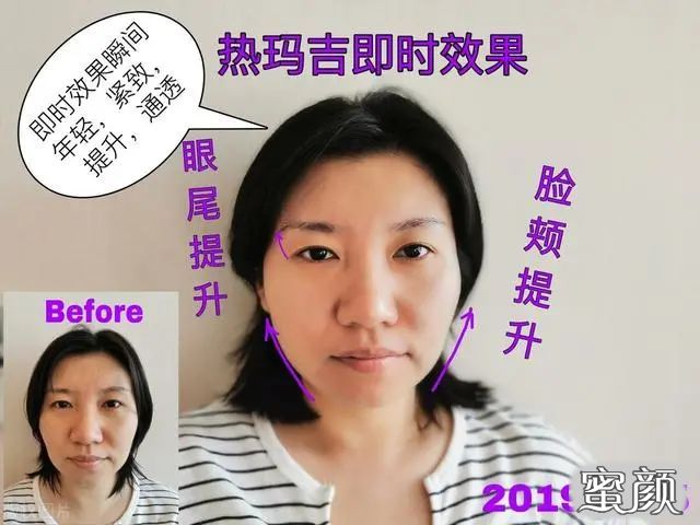 案例图片