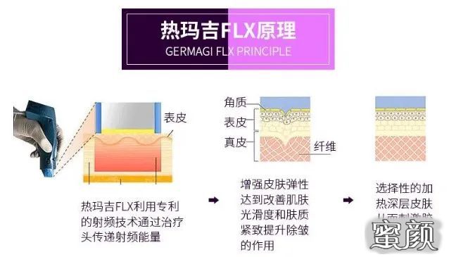 https://img.yiyiaimei.com/mnt/timg/200802/1304552440-1.jpg 案例图片