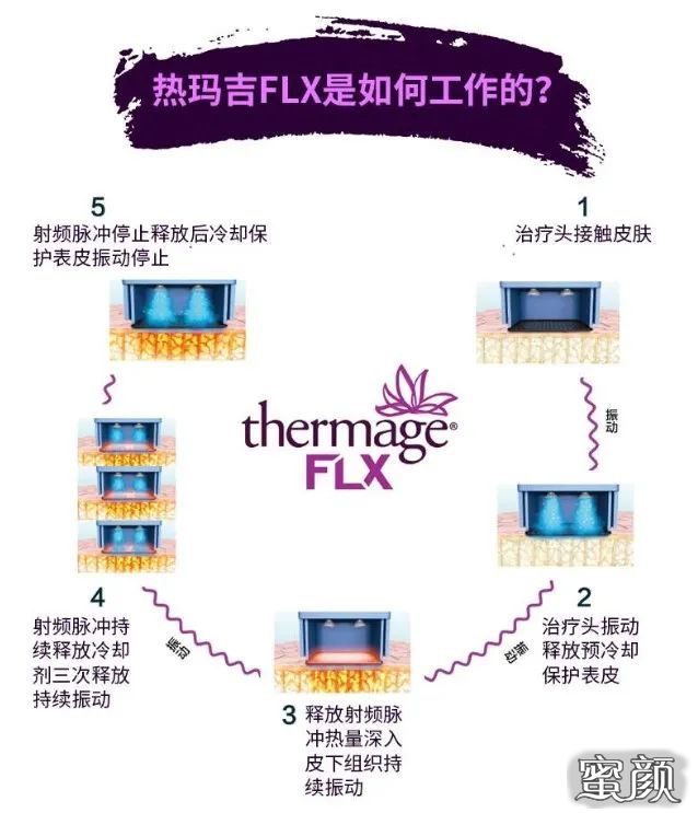 https://img.yiyiaimei.com/mnt/timg/200802/13045VC4-6.jpg 案例图片