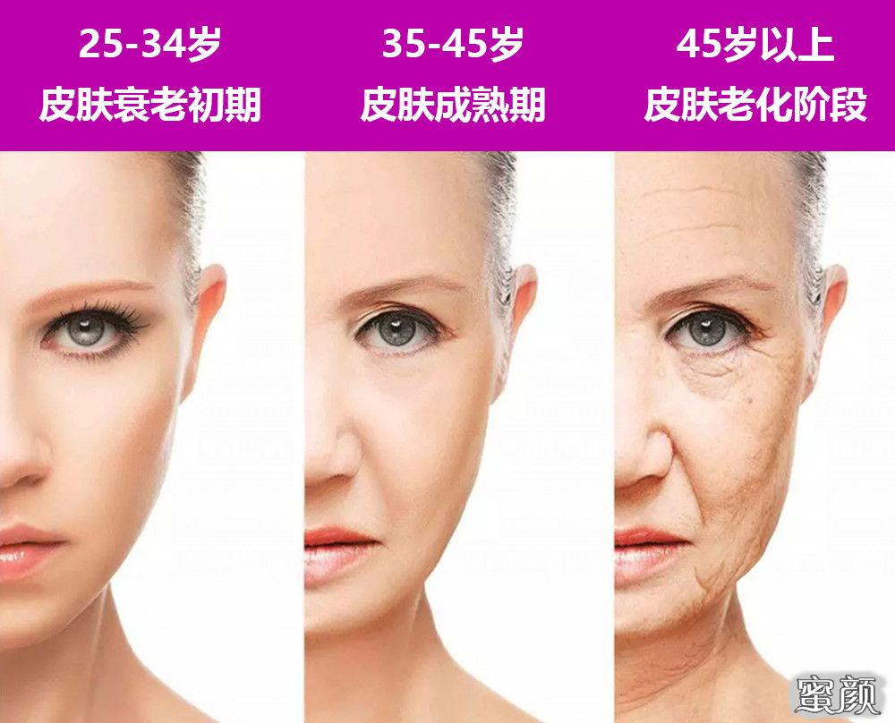 https://img.yiyiaimei.com/mnt/timg/200802/130503JT-7.jpg 案例图片