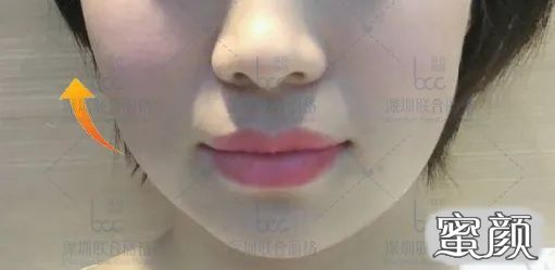https://img.yiyiaimei.com/mnt/timg/200804/10561H424-0.jpg 案例图片