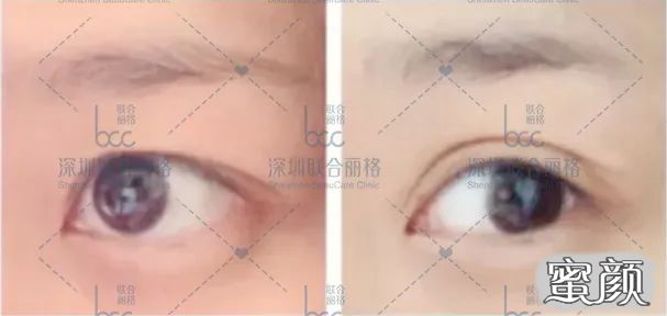 案例图片