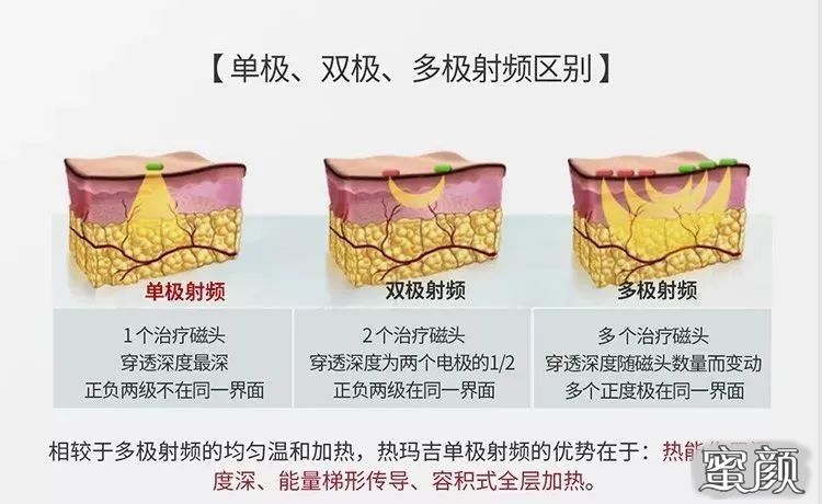 案例图片