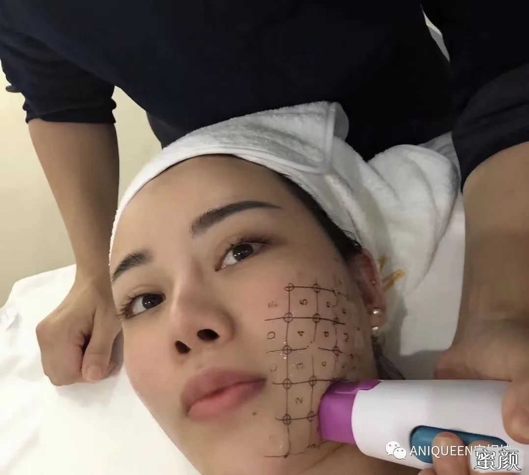 案例图片