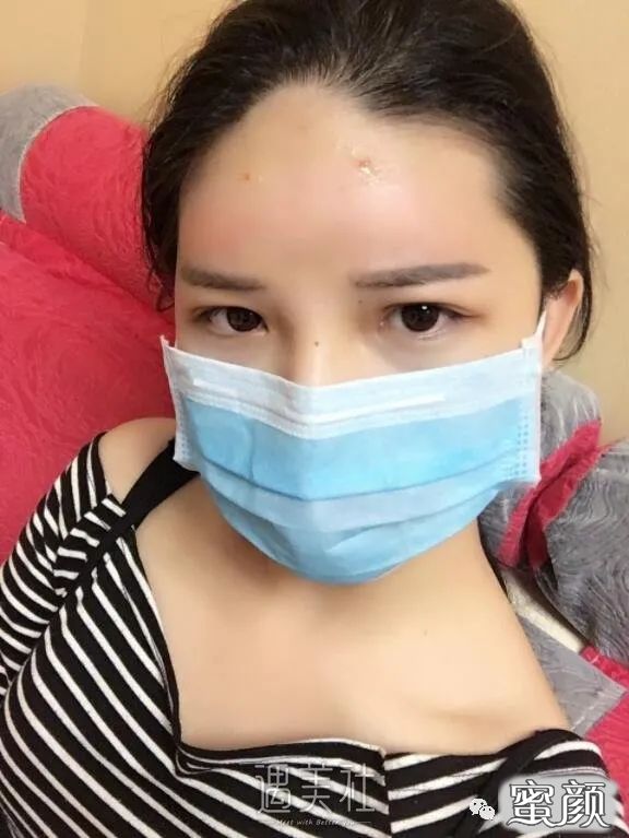 https://img.yiyiaimei.com/mnt/timg/200804/1213151061-2.jpg