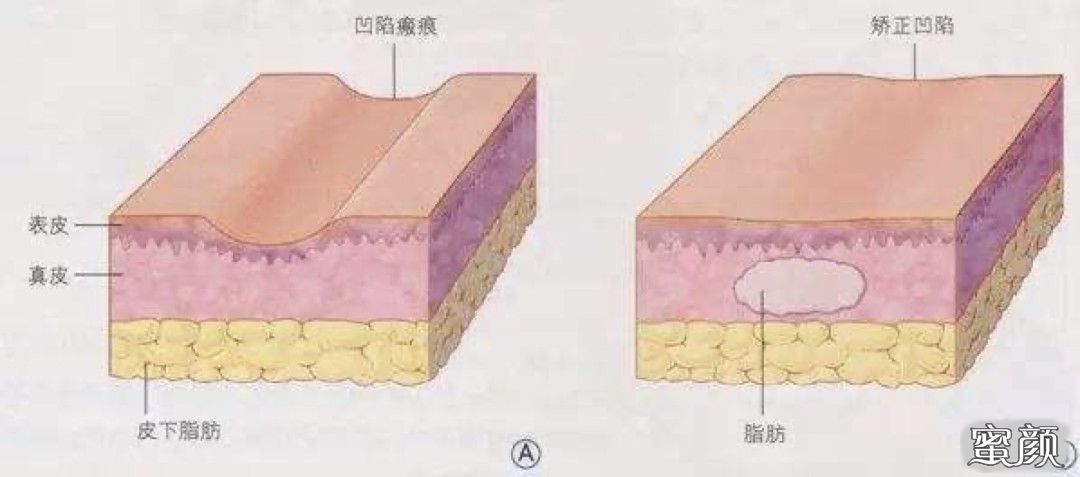 https://img.yiyiaimei.com/mnt/timg/200805/092K92D6-2.jpg