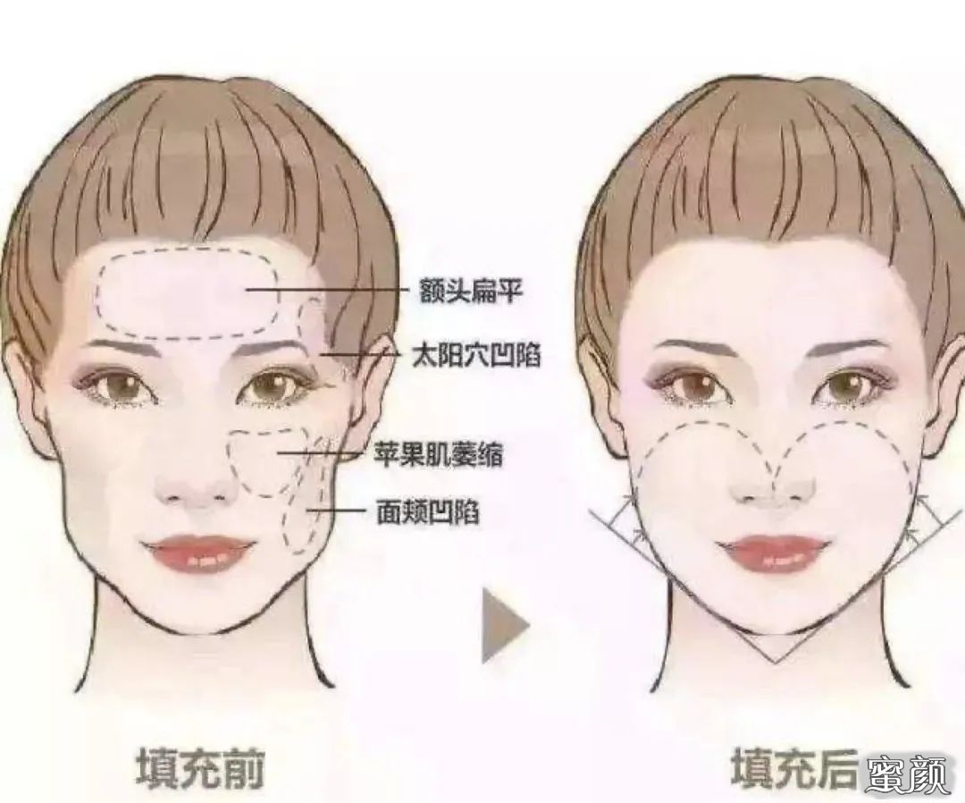 https://img.yiyiaimei.com/mnt/timg/200805/092P0I04-3.jpg