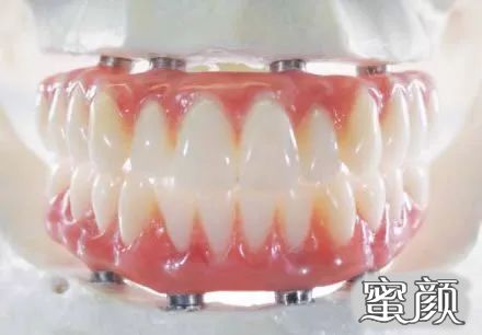 https://img.yiyiaimei.com/mnt/timg/200805/103H231M-2.jpg 案例图片