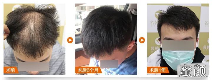 案例图片