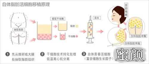 案例图片
