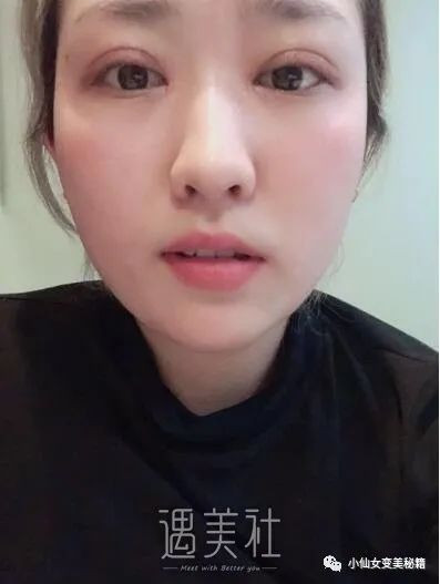 案例图片