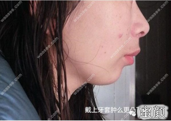 案例图片
