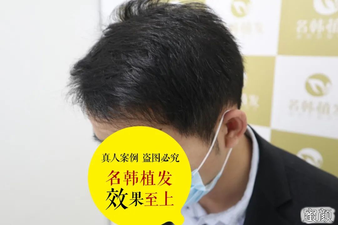 案例图片
