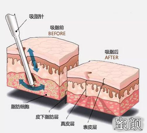 案例图片