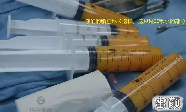 https://img.yiyiaimei.com/mnt/timg/200806/110Q021O-8.jpg 案例图片