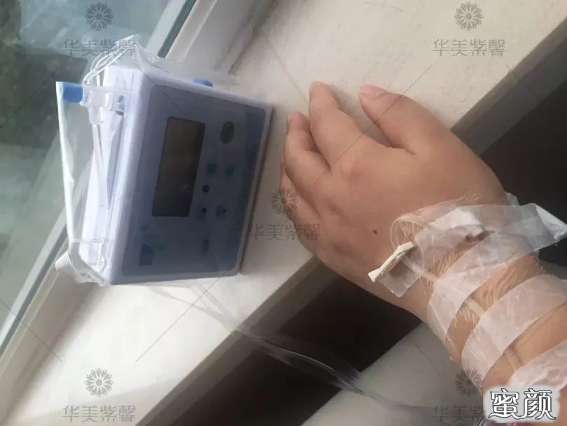 https://img.yiyiaimei.com/mnt/timg/200806/110Q16457-9.jpg 案例图片