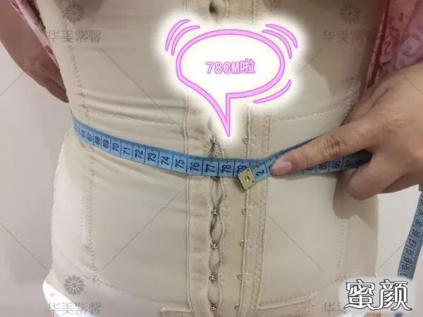 https://img.yiyiaimei.com/mnt/timg/200806/110Q22228-12.jpg 案例图片
