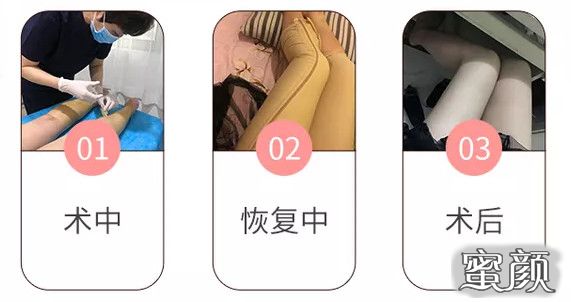 案例图片