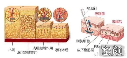 案例图片