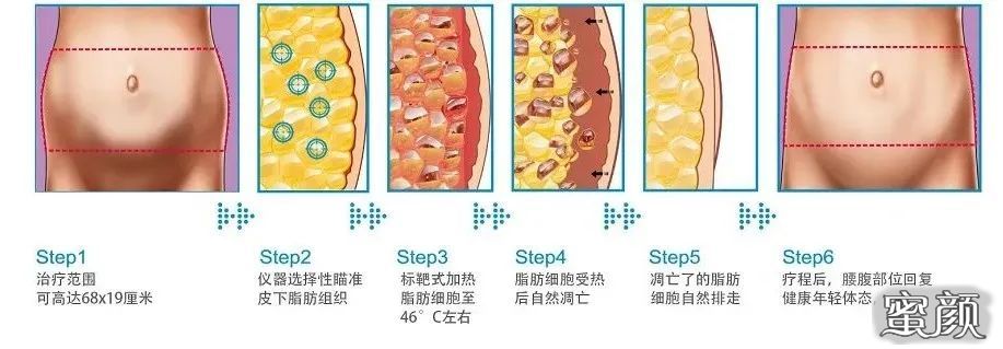 案例图片