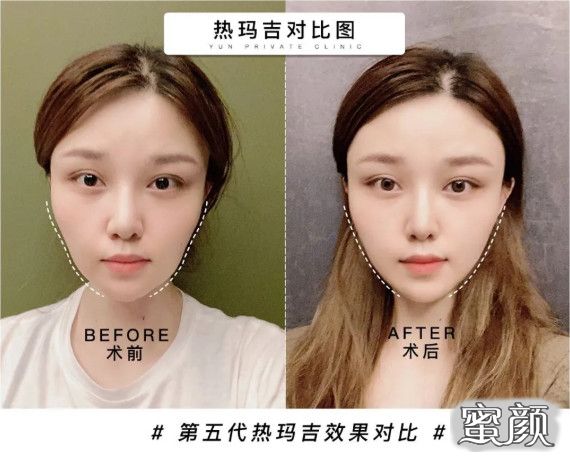 https://img.yiyiaimei.com/mnt/timg/200806/12030123M-5.jpg
