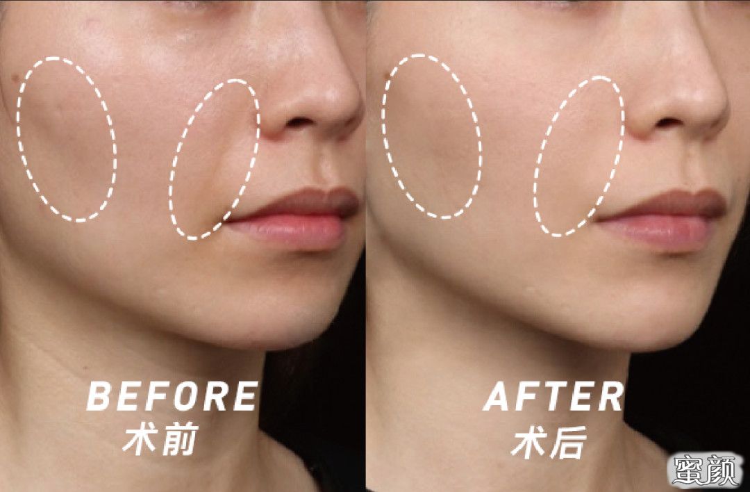 https://img.yiyiaimei.com/mnt/timg/200806/1203101358-12.jpg