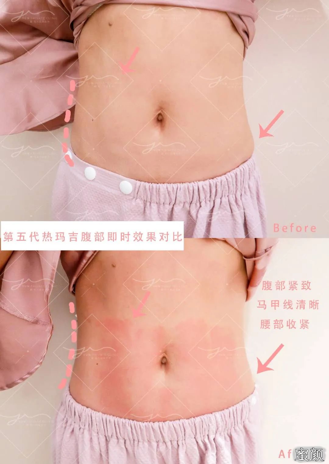 https://img.yiyiaimei.com/mnt/timg/200806/1203112531-14.jpg